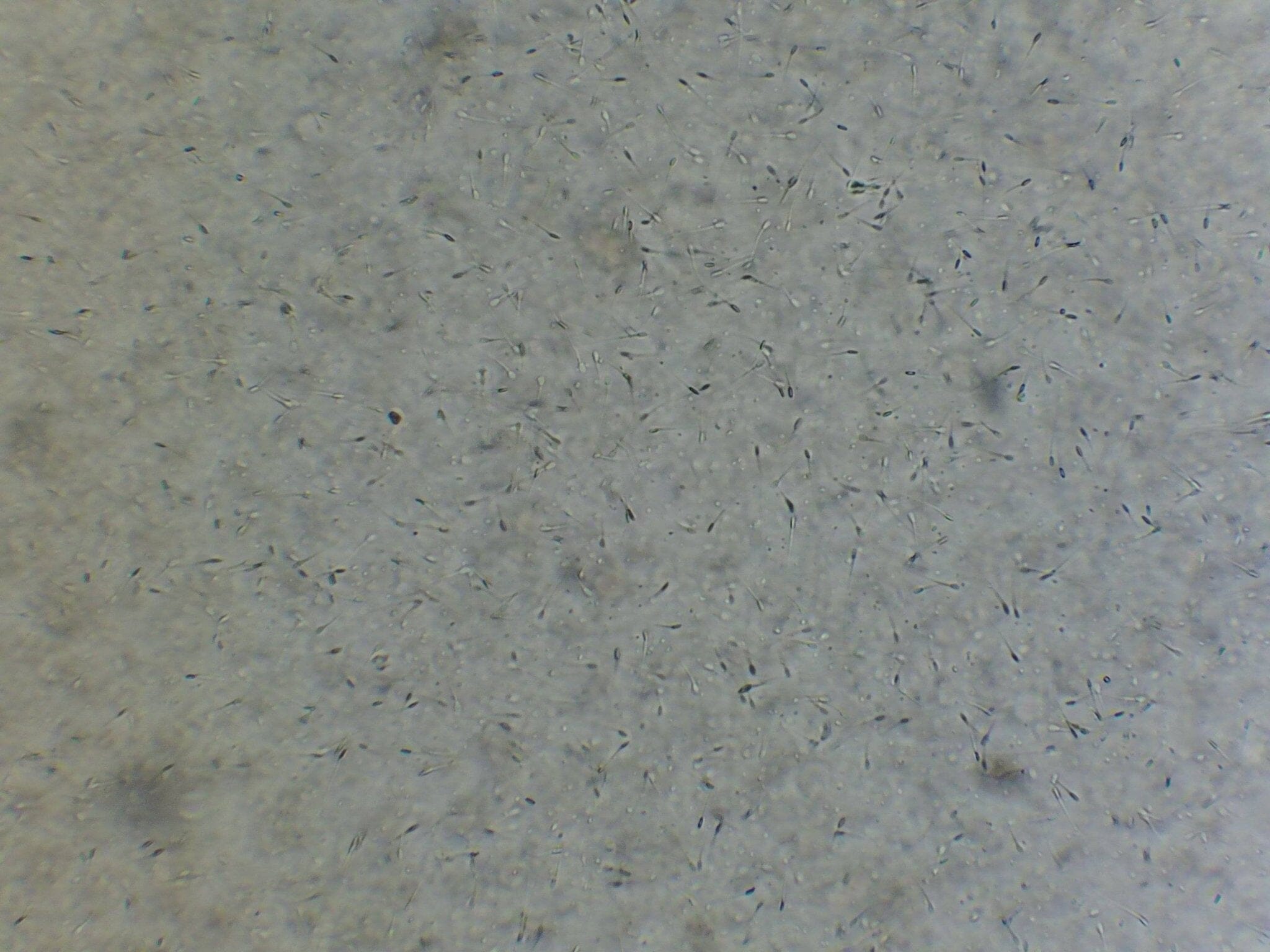 Vet Grade Canine Semen Analysis Microscope Kit 2500X - Canine P4