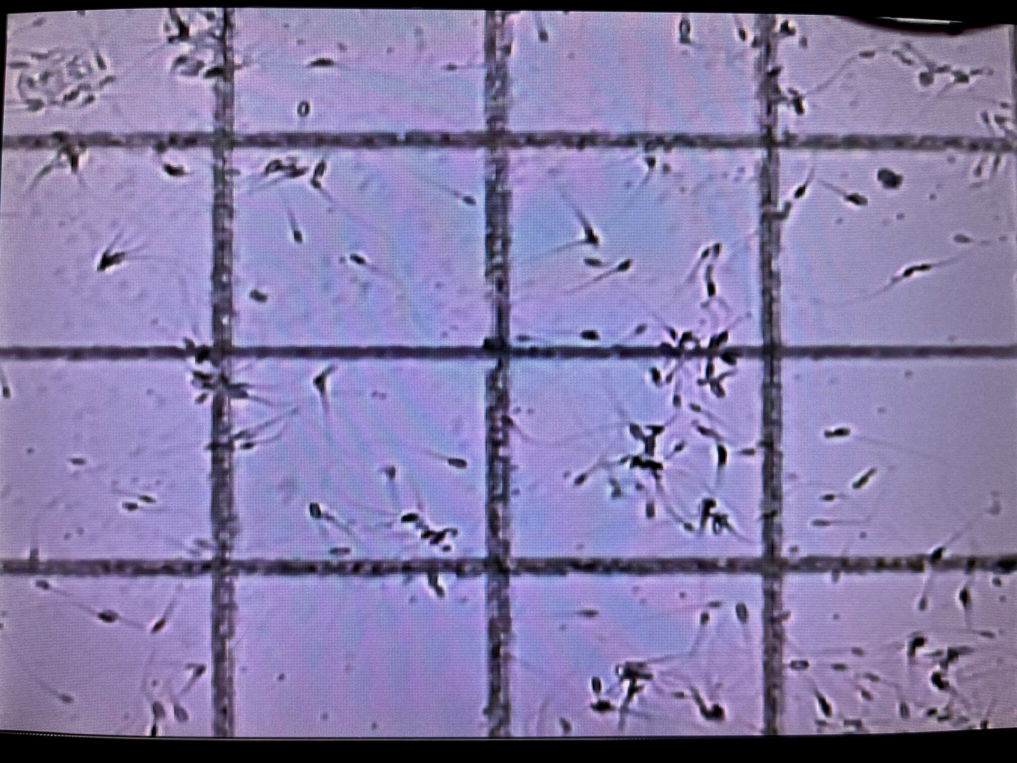 Cell - Vu Disposable Sperm Counting Chamber DRM - 600 (50ct) - Canine P4