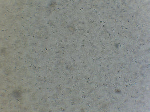 Canine Semen Analysis Dual Screen & Binocular Microscope Kit - Canine P4 Dot Com
